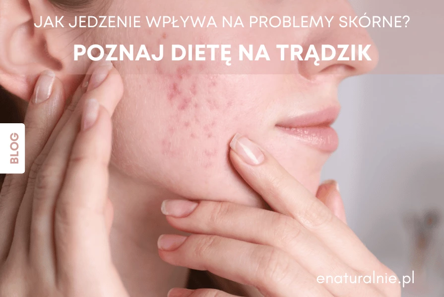 Dieta na trądzik – co jeść, aby pozbyć się tego wstydliwego problemu?